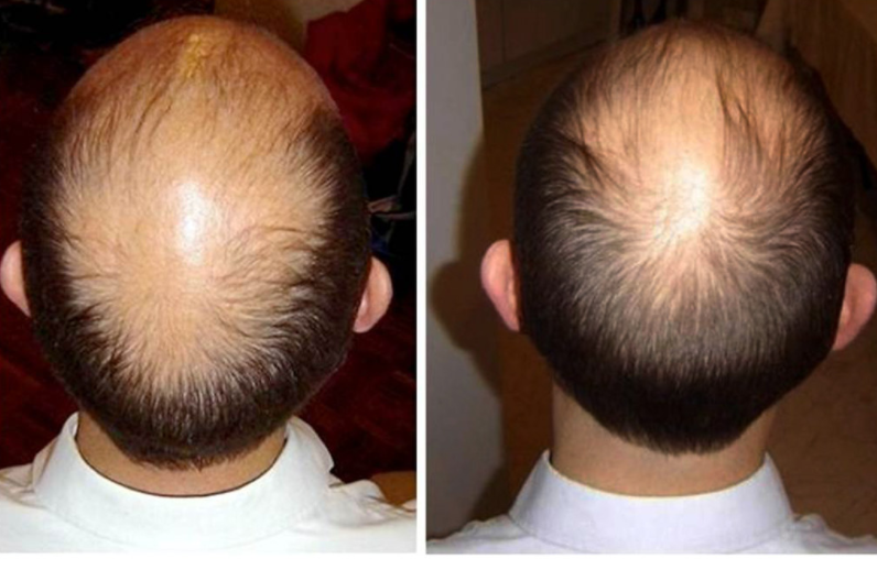 ageLOC Nutriol Shampoo - šampón na podporu rastu vlasov